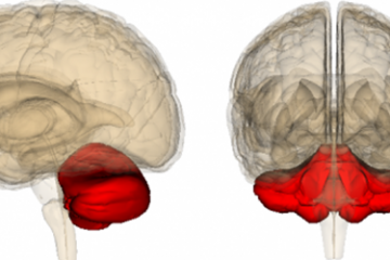 Phương pháp chuẩn đoán dấu hiệu teo tiểu não