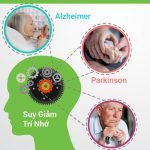 Những nguyên nhân gây suy giảm trí nhớ và cách phòng tránh