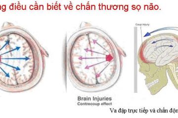 Tổng quan về chấn thương sọ não