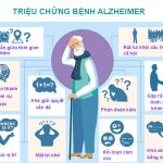 8 Triệu chứng bệnh Alzheimer rõ nét, phổ biến hay gặp nhất
