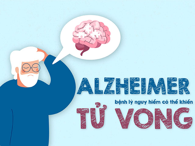 Bệnh Alzheimer có chết không