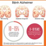 Bệnh Alzheimer sống được bao lâu kể từ khi phát hiện bệnh